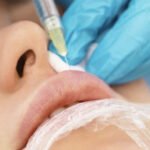 The Importance of Skillful Lip Enhancement Practices